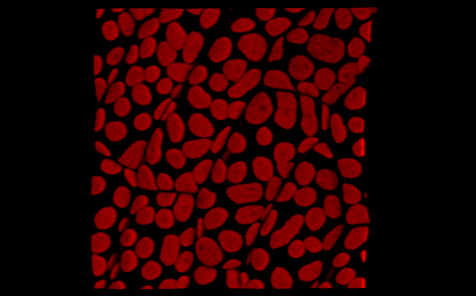 Fig.1: Moss leaflet cells with chloroplasts showing red fluorescence.